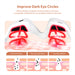 Microcurrent EMS Eye Beauty Massager with Red Light Therapy for Dark Circle Reduction
