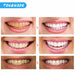 Oral Hygiene Kit Teeth Whitening LED Light Peroxide Gel Dental Bleaching Tool