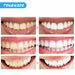 Oral Hygiene Kit Teeth Whitening LED Light Peroxide Gel Dental Bleaching Tool