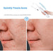 4 In 1 High Frequency Electrotherapy Electrode Light Acne Wand Skin Care Acne Remover